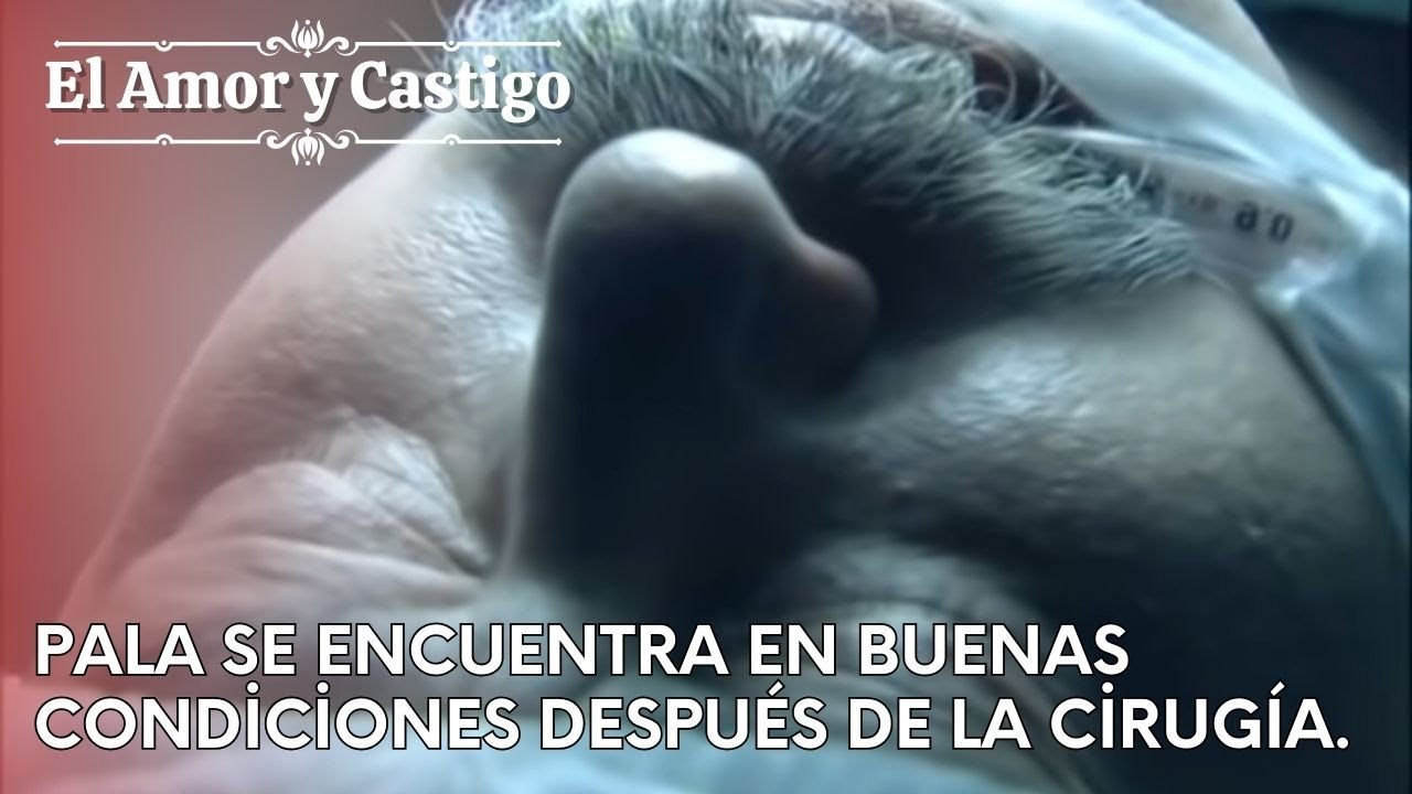 Pala se encuentra en buenas condiciones después de la cirugía. | Amor y Castigo - Capitulo 24