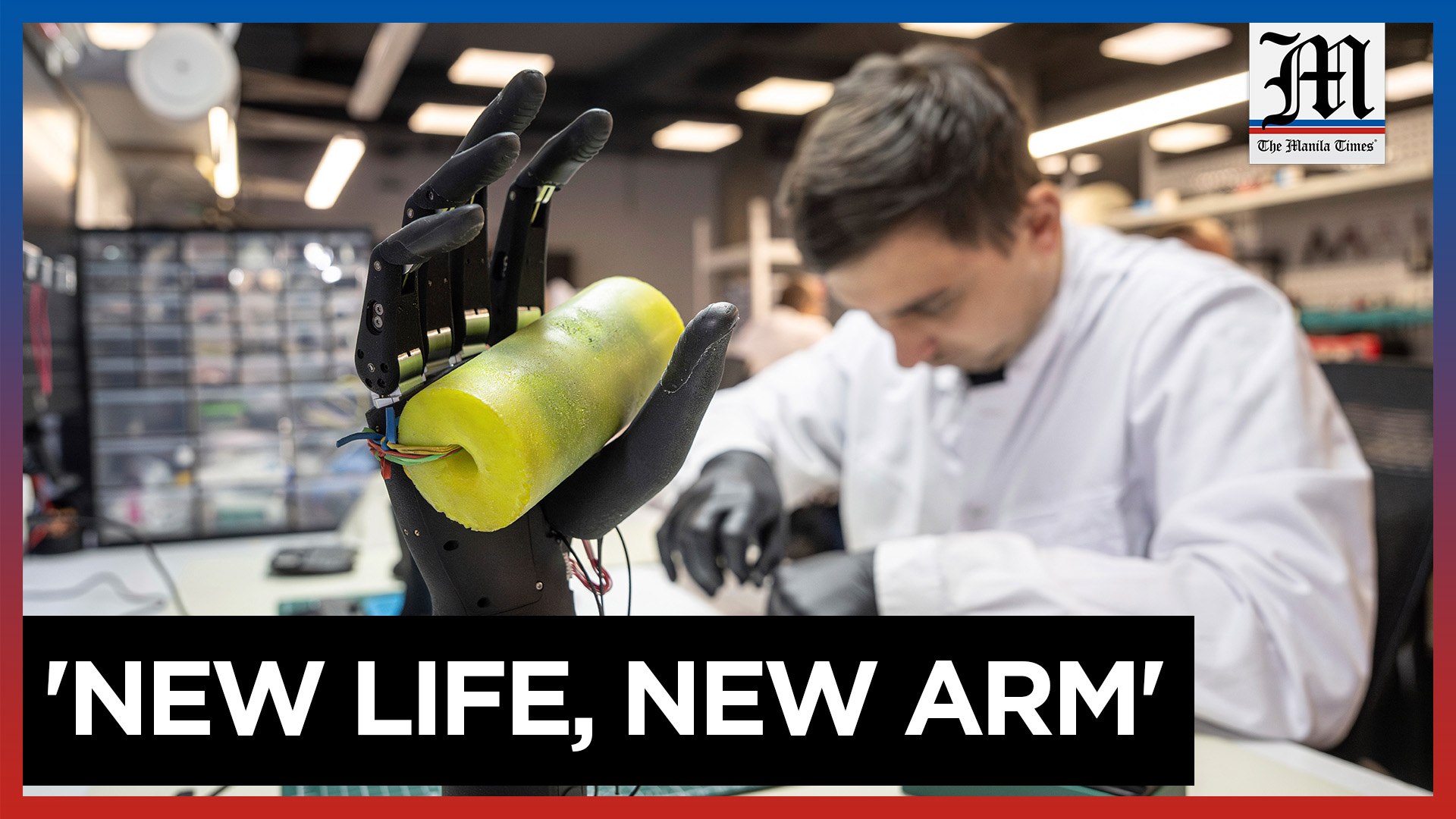 ⁣Ukrainian war veteran embraces bionic limb advancements