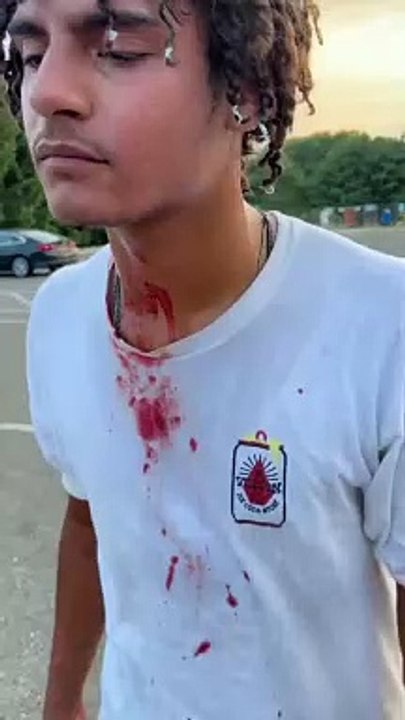 Skateboarder does backside 180 from stairs at skatepark faceplants on pavement and hits chin