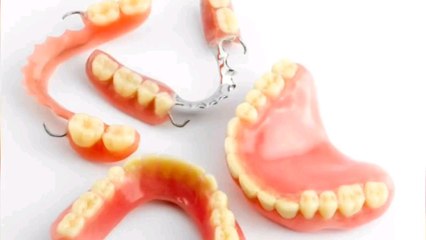 صور لأشخاص بأطقم أسنان و تركيبات سيئة غيرت شكلهم للأسوأ !!!