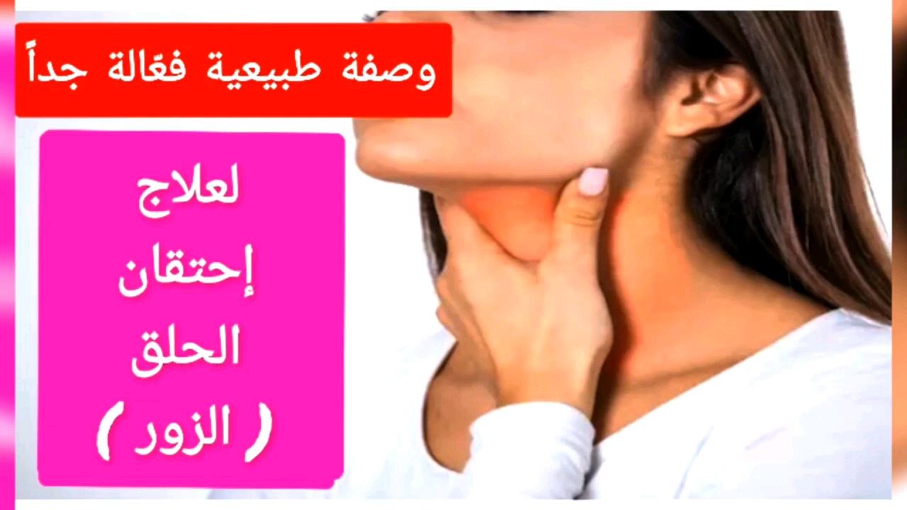 علاج احتقان و ألم الزور ( الحلق) بصفة طبيعية منزلية فعالة