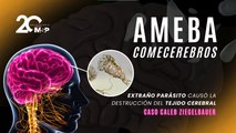 Ameba comecerebros: extraño parásito causó la destrucción del tejido cerebral - Caso Caleb Ziegelbauer