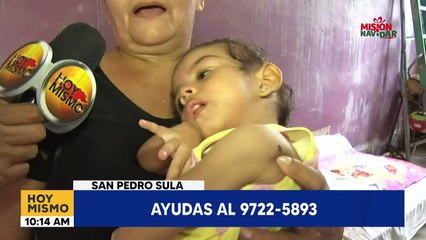 abuela de niña con parálisis cerebral solicita ayuda para pagar sus tratamientos