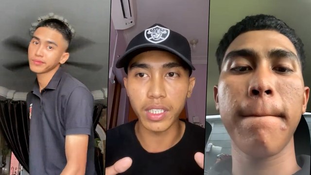 Pemuda menangis tengok cermin, kena ejek jumpa depan-depan muka berjerawat