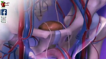 د فارس عرب يشرح: كيف تقوي الانتصاب  بوصفة طبيعية- حالة واقعية