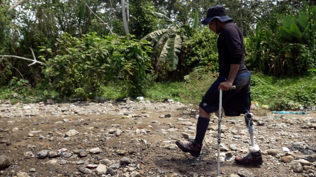 Así fue la odisea de Marcel, el venezolano que caminó desde su país hasta Estados Unidos con una prótesis de pierna