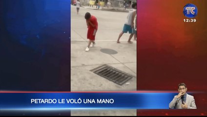 Menor perdió una mano por una detonación de un aparato explosivo