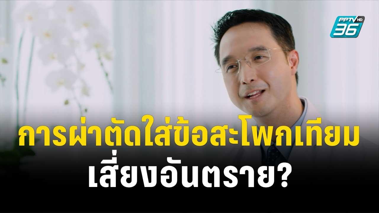 1 นาทีสุขภาพดี กับ BDMS การผ่าตัดใส่ข้อสะโพกเทียมเสี่ยงอันตราย?  | โชว์ข่าวเช้านี้ | 29 ธ.ค. 66