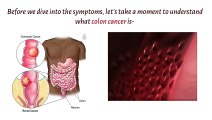 Critical Colon Cancer Symptoms You Should Never Ignore