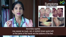 Understanding Syphilis - Symptoms I Diagnosis I Treatment