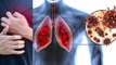 सीने में दर्द से Lungs Damage कैसे होते है | Causes Of Chest Pain In Left Side|Boldsky