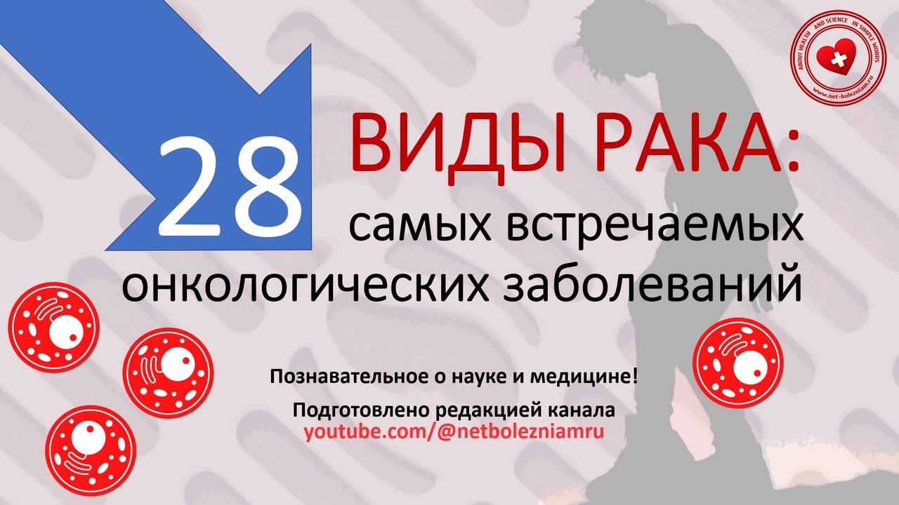 28 самых частых видов рака: особенности, риски распространения (метастазов) и лечение