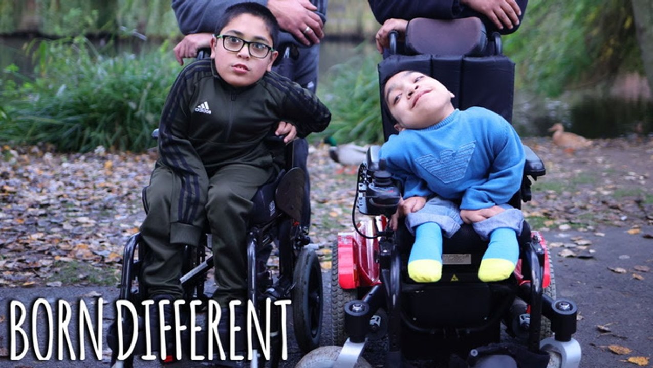 Cousins' Ultra-Rare Condition Makes Them 'Twins' | BORN DIFFERENT