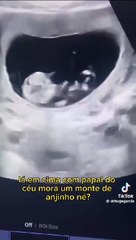 Tải video: Triplo Choque! Pai desmaia em ultrassom ao descobrir gravidez de trigêmeos