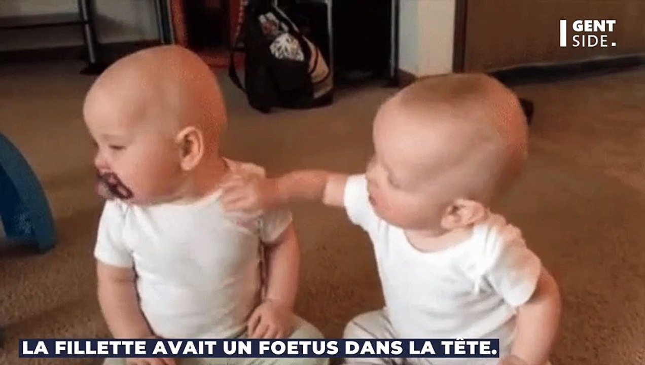 Ce bébé présentait d’importants troubles moteurs, voici ce que les médecins ont découvert dans son cerveau