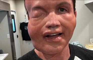 Rob McElhenney is being  compared to Sloth from ‘The Goonies’