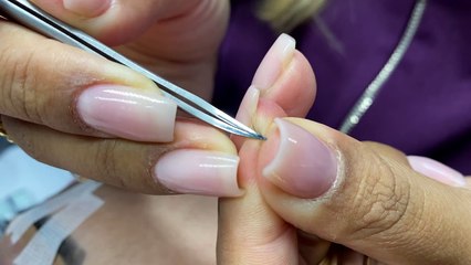 Procedimento na Prática