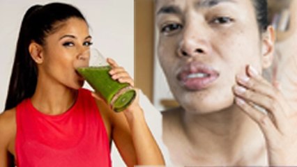 Télécharger la video: Sardi Mein Lauki Ka Juice Pine Ke Fayde, Pimple से लेकर Soft Skin Benefits | Boldsky