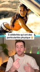 5 célébrités qui ont des particularités physique !