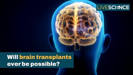 Will Brain Transplants Ever Be Possible? | LiveScience