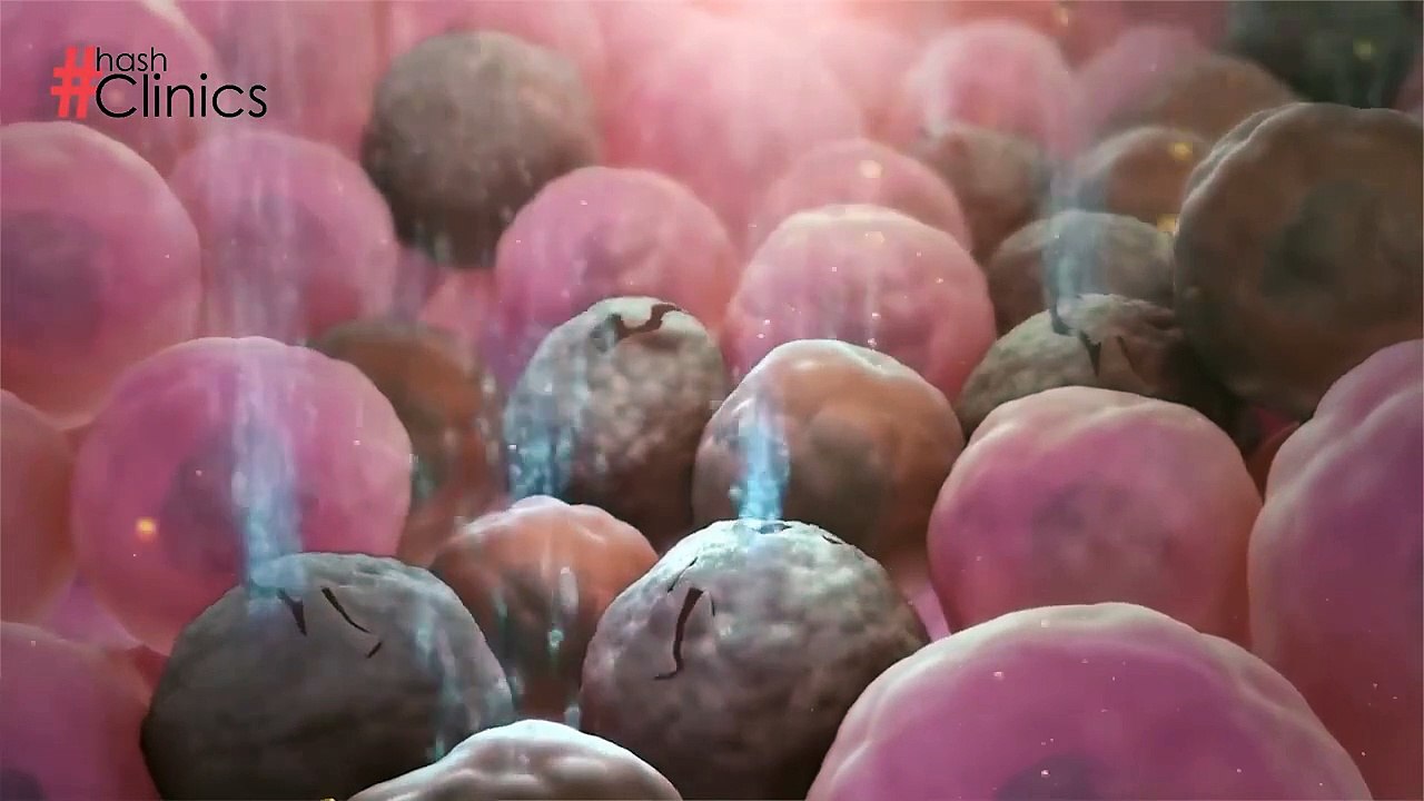 Erectile Dysfunction Causes & Treatment _ HASH CLINICS