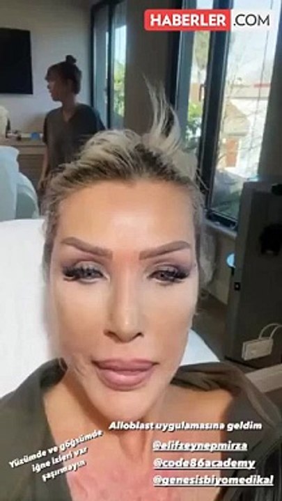 Seda Sayan, sünnet derisinden elde edilen sıvıyı yüzüne enjekte ettirdi