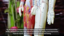 Unlocking Wellness: The Powerful Benefits of Acupuncture for Mental Health