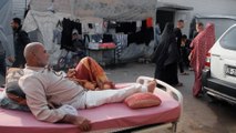 أصوات من غزة.. أطباء يحذرون من نفاد مادة البلاتين لعلاج الكسور