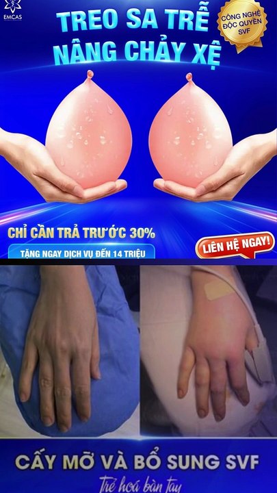 Lời Đồn Bệnh Viện EMCAS Gây Chết Người Và Thực Hư Câu Chuyện