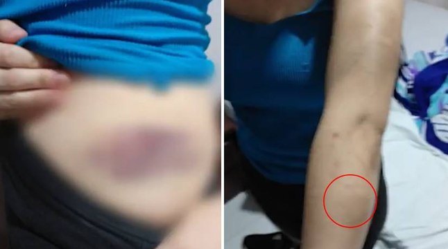 Mexicana sobrevivió a meses de abuso sexual y crueles torturas de su novio en Santander