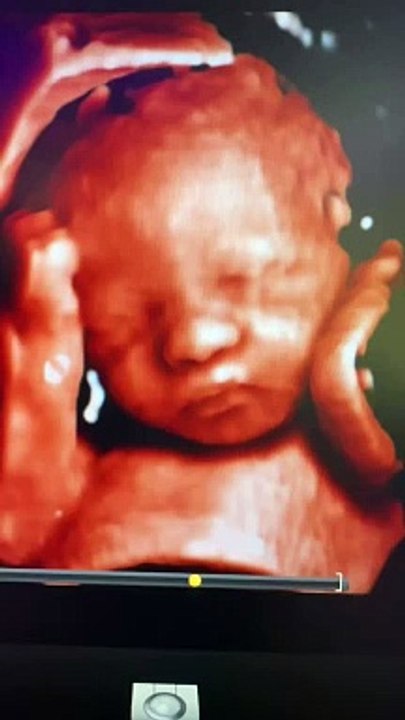 Baby Memories