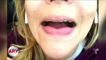 Presentadora de televisión desfigura sus labios por culpa de una inyección