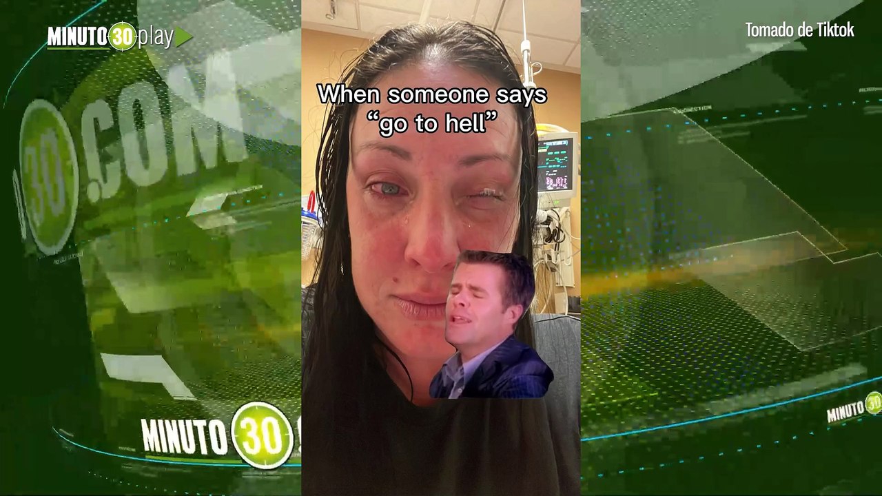 Con los ojos pegados Así quedó mujer que confun...