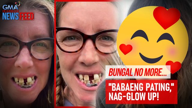 Bungal no more! Babaeng pating, nag-glow up! | GMA Integrated Newsfeed
