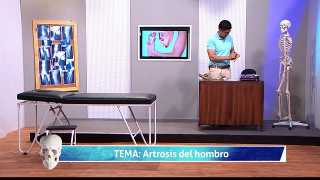 18 ARTROSIS DE HOMBRO 1_1