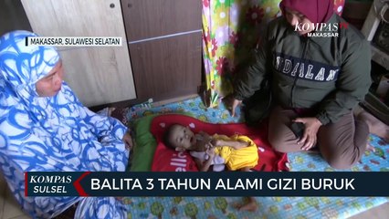 Balita 3 Tahun Warga Kandea Tiga, Alami Gizi Buruk