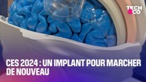 CES 2024: cet implant cérébral permet aux personnes paraplégiques de marcher de nouveau