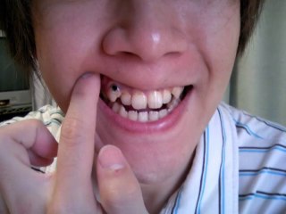 【悲報】ムスカ大佐が歯医者に行かれたようです