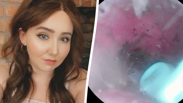 Woman Finds a Spider Nest IN HER EAR