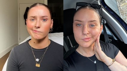 "I thought I had a cold but mystery illness left my face paralysed"