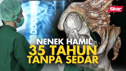 Nenek hamil 35 tahun tanpa sedar