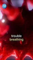 UAE: This is why many kids have been getting sick recently