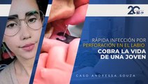 Infección por perforación o piercing en el labio cobra la vida de joven: caso Andressa Souza - #MSP