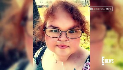 Tải video: 1000-Lb. Sisters' Tammy Slaton FIRES BACK at Haters Criticizing Her Teeth _ E! N