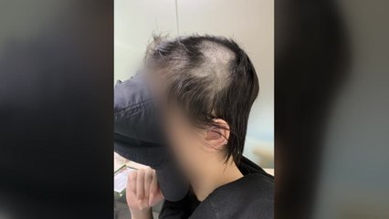 檢, '애인 머리 밀고 얼굴에 소변' 남성에 징역 10년 구형 / YTN