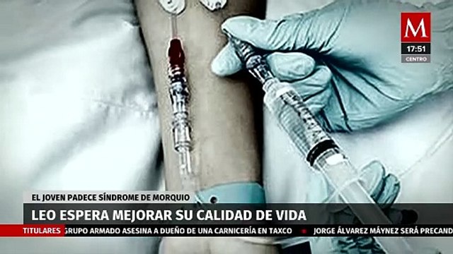 Joven con síndrome de Morquio espera mejorar su calidad de vida con ayuda del IMSS
