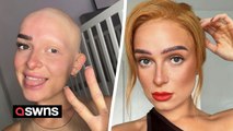 Woman with alopecia gets ready for work the night before and sleeps with her hair and eyebrows done