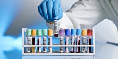 Un test révolutionnaire pour détecter 18 cancers précocement en phase d'expérimentation.