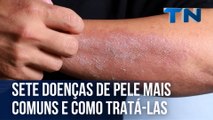 Sete doenças de pele mais comuns e como tratá-las