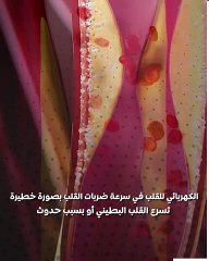 تفاصيل خطة التعامل مع حالات توقف القلب المفاجئ